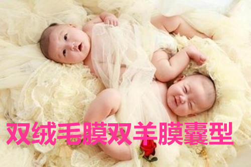 双绒毛膜双羊膜囊型