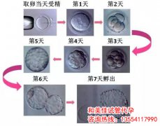 什么是不孕不育抗体7项